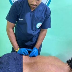 Dry Needling